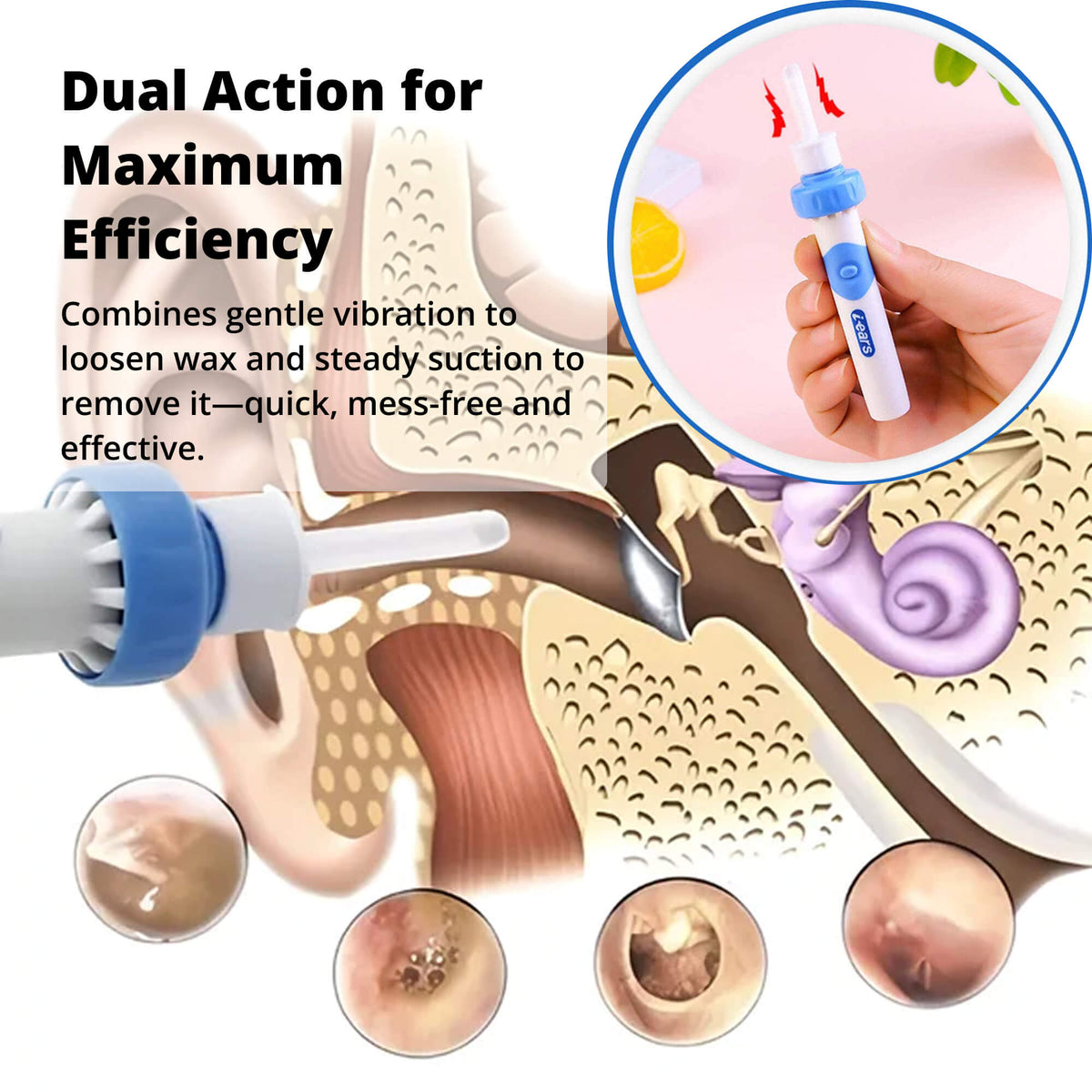 Electric Ear Wax Suction Tool with Medical Grade Silicone Tip and 60-Minute  Battery